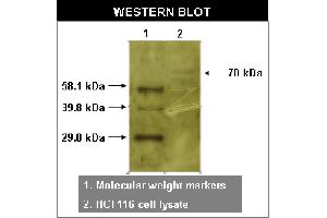 Western blot using RYK antibody   on HCT116 cell lysates. (TXK anticorps)