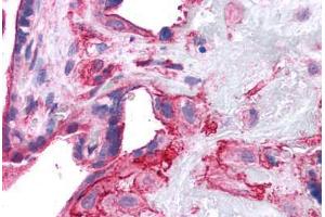 Human Placenta: Formalin-Fixed, Paraffin-Embedded (FFPE)