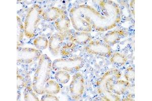 Immunohistochemistry of paraffin-embedded Rat kidney using WRB Polyclonal Antibody at dilution of 1:200 (40x lens). (WRB anticorps)