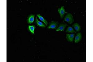 Immunofluorescent analysis of A549 cells using ABIN7142496 at dilution of 1:100 and Alexa Fluor 488-congugated AffiniPure Goat Anti-Rabbit IgG(H+L) (RPS15 anticorps  (AA 63-137))