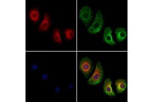 ABIN7094454 and ABIN7098502 staining Hela cells by IF/ICC.