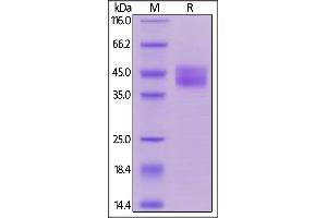 Biotinylated Human CD84, His,Avitag on  under reducing (R) condition.