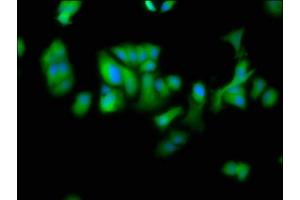 Immunofluorescence staining of MCF-7 cells with ABIN7150910 at 1:100, counter-stained with DAPI. (DTNBP1 anticorps  (AA 258-351))