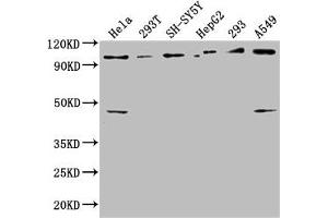 Western Blot Positive WB detected in: Hela whole cell lysate, 293T whole cell lysate, SH-SY5Y whole cell lysate, HepG2 whole cell lysate, 293 whole cell lysate, A549 whole cell lysate All lanes: RABEP1 antibody at 1:2500 Secondary Goat polyclonal to rabbit IgG at 1/50000 dilution Predicted band size: 100, 96 kDa Observed band size: 100 kDa (RABEP1 anticorps  (AA 1-255))