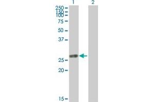 Western Blot analysis of TK1 expression in transfected 293T cell line by TK1 MaxPab polyclonal antibody. (TK1 anticorps  (AA 1-234))