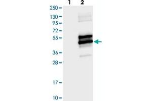 Western blot analysis of Lane 1: Negative control (vector only transfected HEK293T lysate), Lane 2: Over-expression Lysate (Co-expressed with a C-terminal myc-DDK tag (~3.