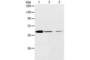 Western Blot analysis of NIH/3T3 and SKOV3 cell, Human ovarian cancer tissue using ABCE1 Polyclonal Antibody at dilution of 1:450 (ABCE1 anticorps)