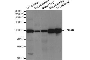 Western Blotting (WB) image for anti-Integrin Alpha2b (CD41) antibody (ABIN1876881) (Integrin Alpha2b anticorps)