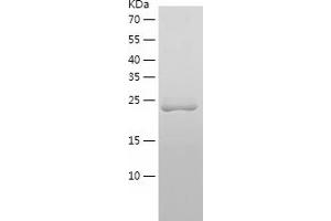 Western Blotting (WB) image for Crystallin, beta A4 (CRYbA4) (AA 1-196) protein (His tag) (ABIN7122502) (CRYbA4 Protein (AA 1-196) (His tag))