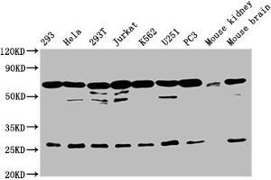 Western Blot Positive WB detected in: 293 whole cell lysate, Hela whole cell lysate, 293T whole cell lysate, Jurkat whole cell lysate, K562 whole cell lysate, U251 whole cell lysate, PC-3 whole cell lysate, Mouse kidney tissue, Mouse brain tissue All lanes: ARIH2 antibody at 1:2000 Secondary Goat polyclonal to rabbit IgG at 1/50000 dilution Predicted band size: 58 kDa Observed band size: 68 kDa (ARIH2 anticorps  (AA 43-360))