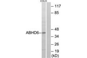 Western blot analysis of extracts from COLO cells, using ABHD6 Antibody. (ABHD6 anticorps  (AA 231-280))