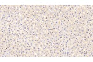 Detection of MSP in Rat Liver Tissue using Polyclonal Antibody to Macrophage Stimulating Protein (MSP) (MST1 anticorps  (AA 489-716))
