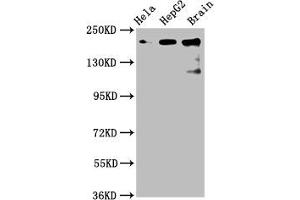 Western Blot Positive WB detected in: Hela whole cell lysate, HepG2 whole cell lysate, Rat brain tissue All lanes: CKAP5 antibody at 6 μg/mL Secondary Goat polyclonal to rabbit IgG at 1/50000 dilution Predicted band size: 226, 219, 227 kDa Observed band size: 226 kDa (CKAP5 anticorps  (AA 1802-2019))