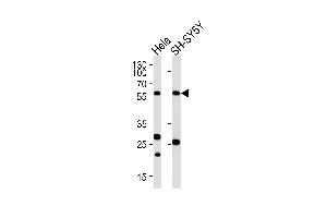 Western blot analysis of lysates from Hela,SH-SY5Y cell line (from left to right),using CALR Antibody (ABIN484301 and ABIN1533682).