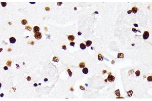 Immunohistochemistry of paraffin-embedded Mouse brain using HNRNPD Polyclonal Antibody at dilution of 1:100 (40x lens).