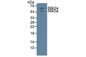 Detection of CD15 in Rat Brain Tissue using Polyclonal Antibody to Cluster Of Differentiation 15 (CD15)