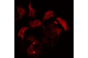 ABIN6274963 staining HepG2  cells by IF/ICC.