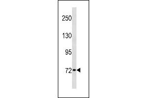 SYN1 Antibody (C-term) (ABIN1881860 and ABIN2843335) western blot analysis in HL-60 cell line lysates (35 μg/lane). (SYN1 anticorps  (C-Term))
