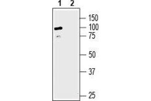 Western blot analysis of human HepG2 liver hepatocellular carcinoma: - 1.