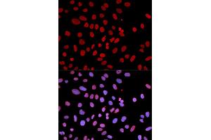 Immunofluorescence analysis of U2OS cells using PTPN6 antibody (ABIN5970673). (SHP1 anticorps)