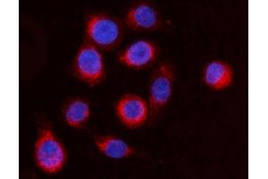 IF analysis of ARFGAP1 using anti-ARFGAP1 antibody (ABIN4886474). (ARFGAP1 anticorps  (AA 1-183))