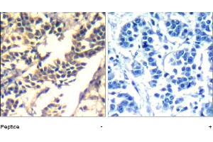 Image no. 1 for anti-Cas-Br-M (Murine) Ecotropic Retroviral Transforming Sequence (CBL) (Tyr700) antibody (ABIN401654) (CBL anticorps  (Tyr700))