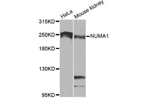 Western blot analysis of extracts of various cell lines, using NUMA1 antibody. (NUMA1 anticorps)