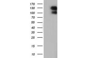 Image no. 1 for anti-Microtubule Associated Monoxygenase, Calponin and LIM Domain Containing 1 (MICAL1) antibody (ABIN1499462) (MICAL1 anticorps)