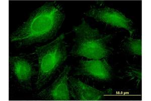 Immunofluorescence of monoclonal antibody to ABCF1 on HeLa cell.