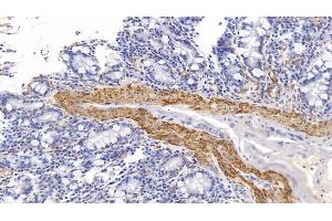 Detection of ACTC1 in Human Small intestine Tissue using Monoclonal Antibody to Actin Alpha 1, Cardiac Muscle (ACTC1)