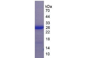 SDS-PAGE analysis of Human LILRB3 Protein. (LILRB3 Protéine)
