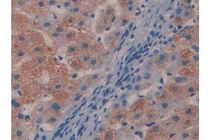 IHC-P analysis of Human Liver Tissue, with DAB staining. (MYL9 anticorps  (AA 5-163))