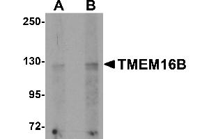 Western blot analysis of TMEM16B in rat brain tissue lysate with TMEM16B antibody at (A) 1 and (B) 2 µg/mL.