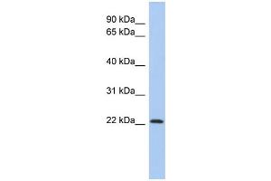 WB Suggested Anti-ZNF833P Antibody Titration:  0. (LOC401898 anticorps  (N-Term))