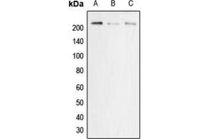 Western blot analysis of p22 phox expression in MCF7 (A), NIH3T3 (B), PC12 (C) whole cell lysates. (CYBA anticorps  (Center))
