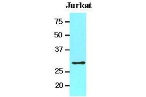 Cell lysates of Jurkat (20 ug) were resolved by SDS-PAGE, transferred to nitrocellulose membrane and probed with anti-human 14-3-3 tau (1:1000).