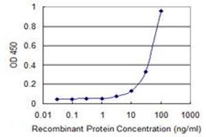 Detection limit for recombinant GST tagged ZSCAN1 is 1 ng/ml as a capture antibody. (ZSCAN1 anticorps  (AA 315-407))