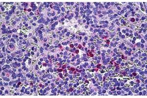 Human Spleen: Formalin-Fixed, Paraffin-Embedded (FFPE) (Retinol Binding Protein 5 anticorps  (AA 10-59))