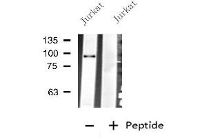 Western blot analysis of extracts from Jurkat cells, using PLG antibody. (PLG anticorps  (Internal Region))