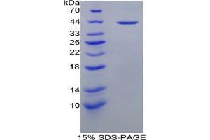 SDS-PAGE of Protein Standard from the Kit (Highly purified E. (Major Basic Protein Kit ELISA)