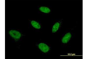 Immunofluorescence of monoclonal antibody to NFYB on HeLa cell. (NFYB anticorps  (AA 1-207))