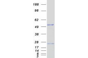 Validation with Western Blot (NUDT12 Protein (Myc-DYKDDDDK Tag))