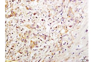 Immunohistochemistry (Paraffin-embedded Sections) (IHC (p)) image for anti-CD34 (CD34) (AA 201-300) antibody (ABIN676898)