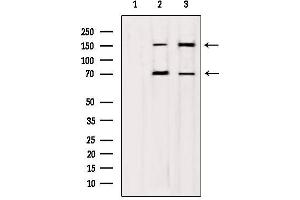 Western blot analysis of extracts from various samples, using mDia1 Antibody. (DIAPH1 anticorps)