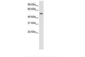 Image no. 1 for anti-Death Inducer-Obliterator 1 (DIDO1) (N-Term) antibody (ABIN6736175) (DIDO1 anticorps  (N-Term))