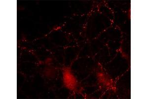 Indirect immunostaining of cultured hippocampus neurons (dilution 1 : 200).