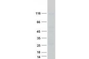 Validation with Western Blot