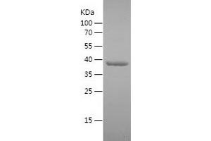 Western Blotting (WB) image for DEAD (Asp-Glu-Ala-Asp) Box Polypeptide 3, Y-Linked (DDX3Y) (AA 196-372) protein (His-IF2DI Tag) (ABIN7122606)