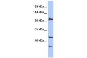 Image no. 1 for anti-XPA Binding Protein 2 (XAB2) (AA 35-84) antibody (ABIN6743564) (XAB2 anticorps  (AA 35-84))