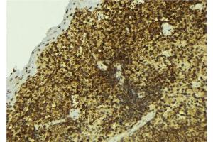 ABIN6277498 at 1/100 staining Mouse pancreas tissue by IHC-P. (NONO anticorps  (C-Term))